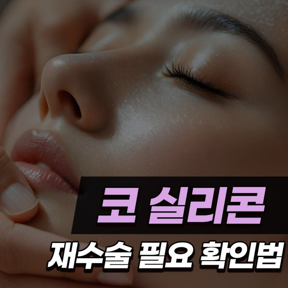 세 번째 코 수술, 자가늑연골로 계획한 이유 — 기증늑연골 수술 후 재수술 사례 관련 이미지 1/10