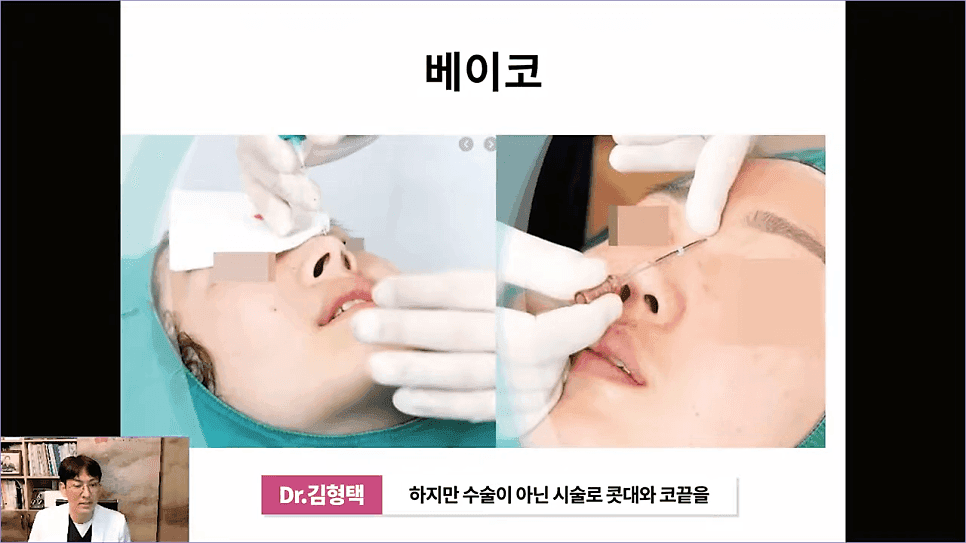 베이코 코실리프팅 후 이물질 제거, 왜 하게 될까 — 실이 문제가 되는 경우 관련 이미지 4/16