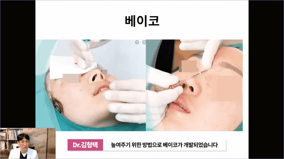 베이코 코실리프팅 후 이물질 제거, 왜 하게 될까 — 실이 문제가 되는 경우 관련 이미지 5/16