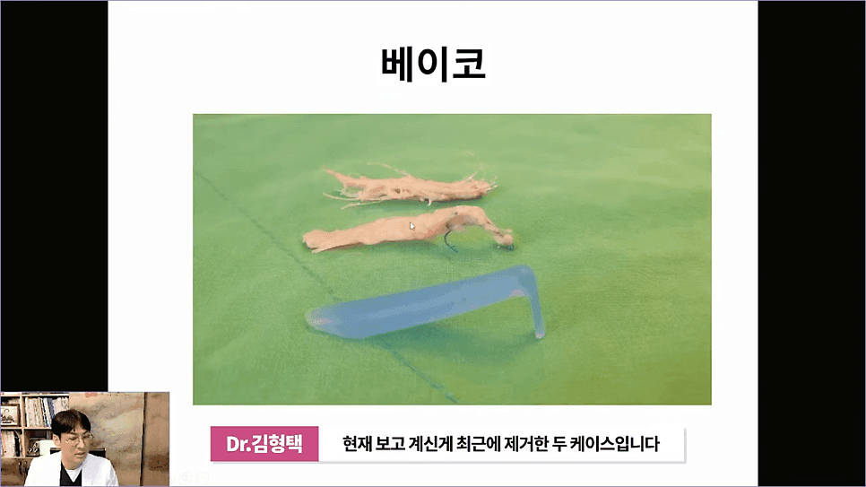 베이코 코실리프팅 후 이물질 제거, 왜 하게 될까 — 실이 문제가 되는 경우 관련 이미지 13/16