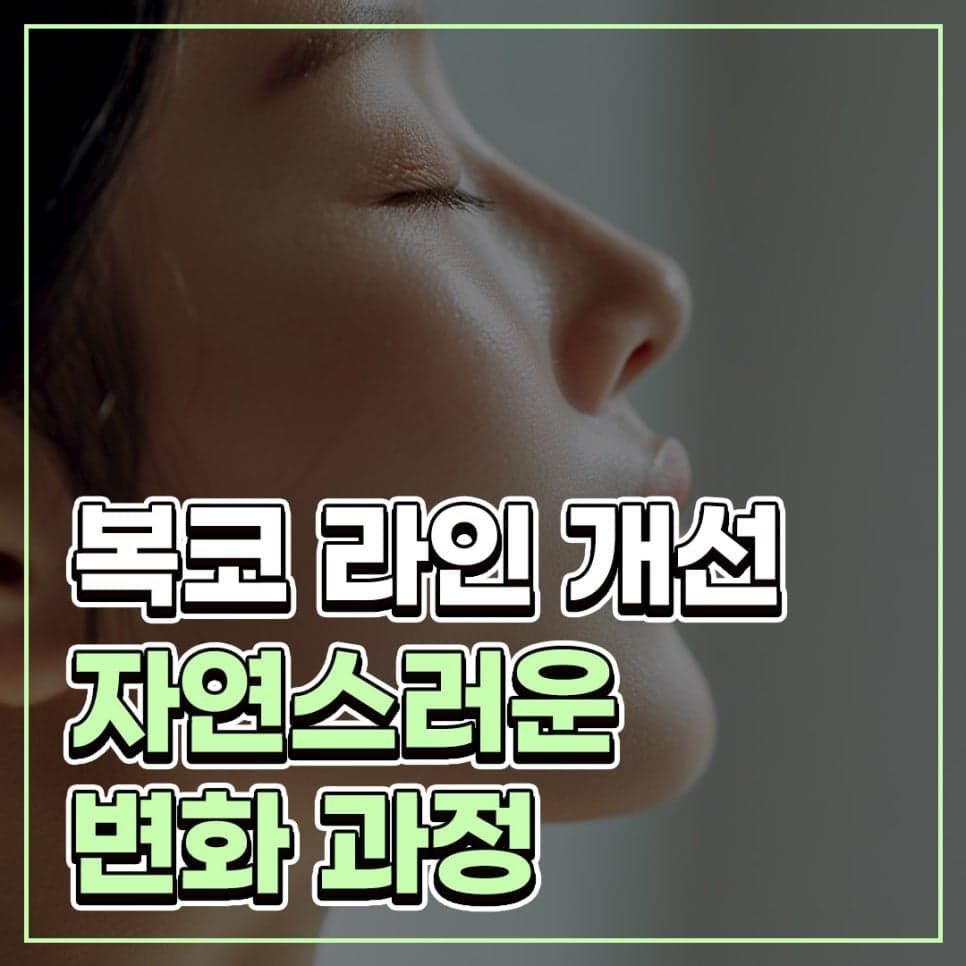 코끝연골재배치로 복코 라인이 정리되는 과정 — 지지 구조와 비순각·인중 균형까지 관련 이미지 1/9
