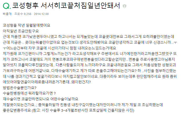 수술 후 코끝처짐, 개선 방법이 코재수술밖에 없나요? — 확인 순서와 수술 범위 관련 이미지 2/9