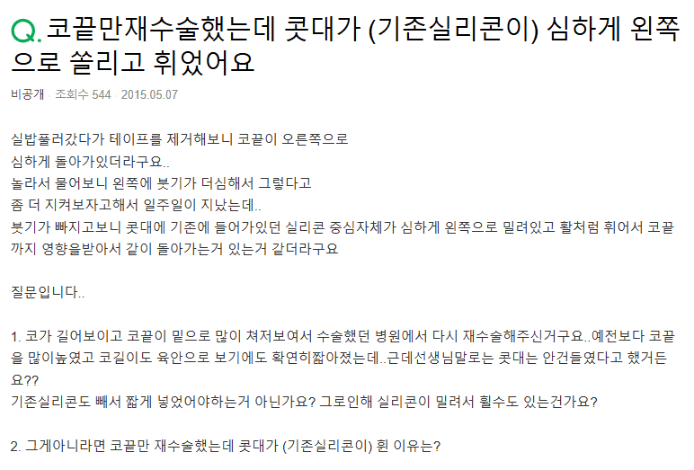 코끝만 재수술했는데 기존 실리콘이 휘었다면 — 원인 확인과 교정 방법의 범위 관련 이미지 2/3