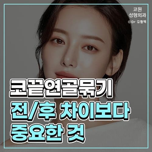 코끝 연골묶기 전후, 모으는 변화보다 중요한 것 — 방향·지지력·각도의 구조적 균형 관련 이미지 1/6