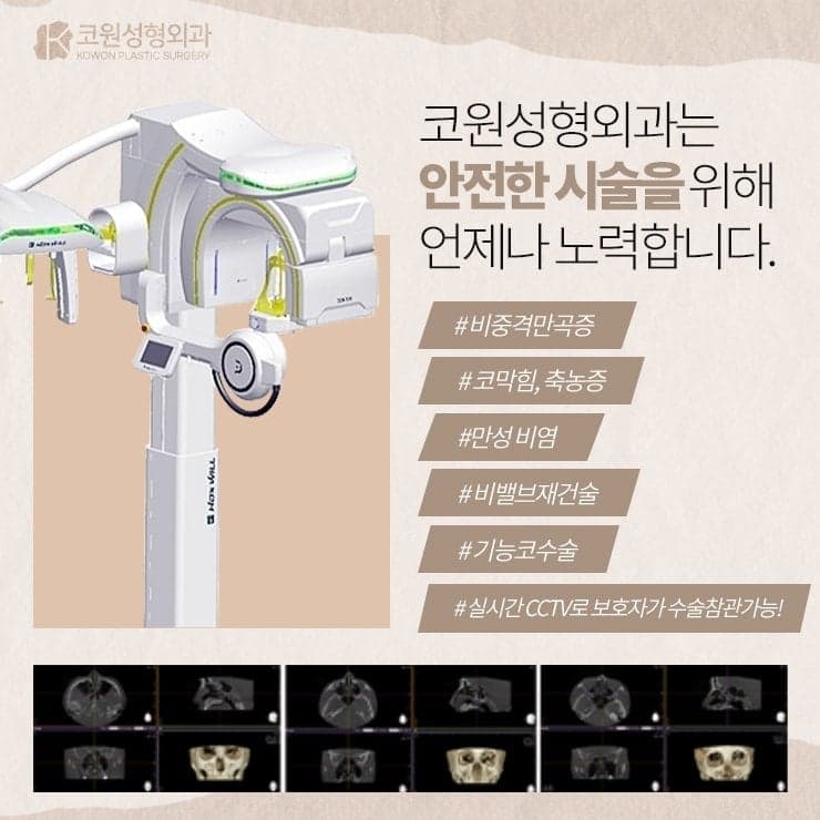 양악 수술을 하면 비중격 연골은 사용할 수 없나요? — 양악 후 코성형 재료 이야기 관련 이미지 3/5