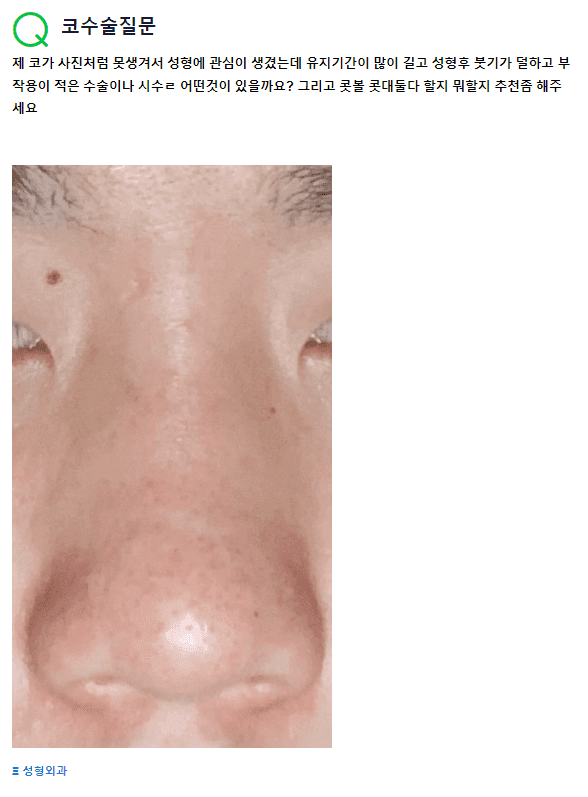 "못생긴코"가 콤플렉스라면 무엇부터 보나 — 정면 사진 한 장으로 판단하기 어려운 이유 (Q&A) 관련 이미지 2/2