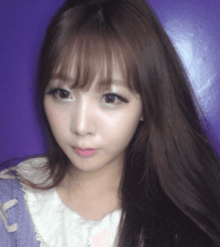 들린코 수술 후 화살코가 됐다면 — 비주 위치·콧등·코끝을 나눠 보는 재수술 기준 관련 이미지 7/7