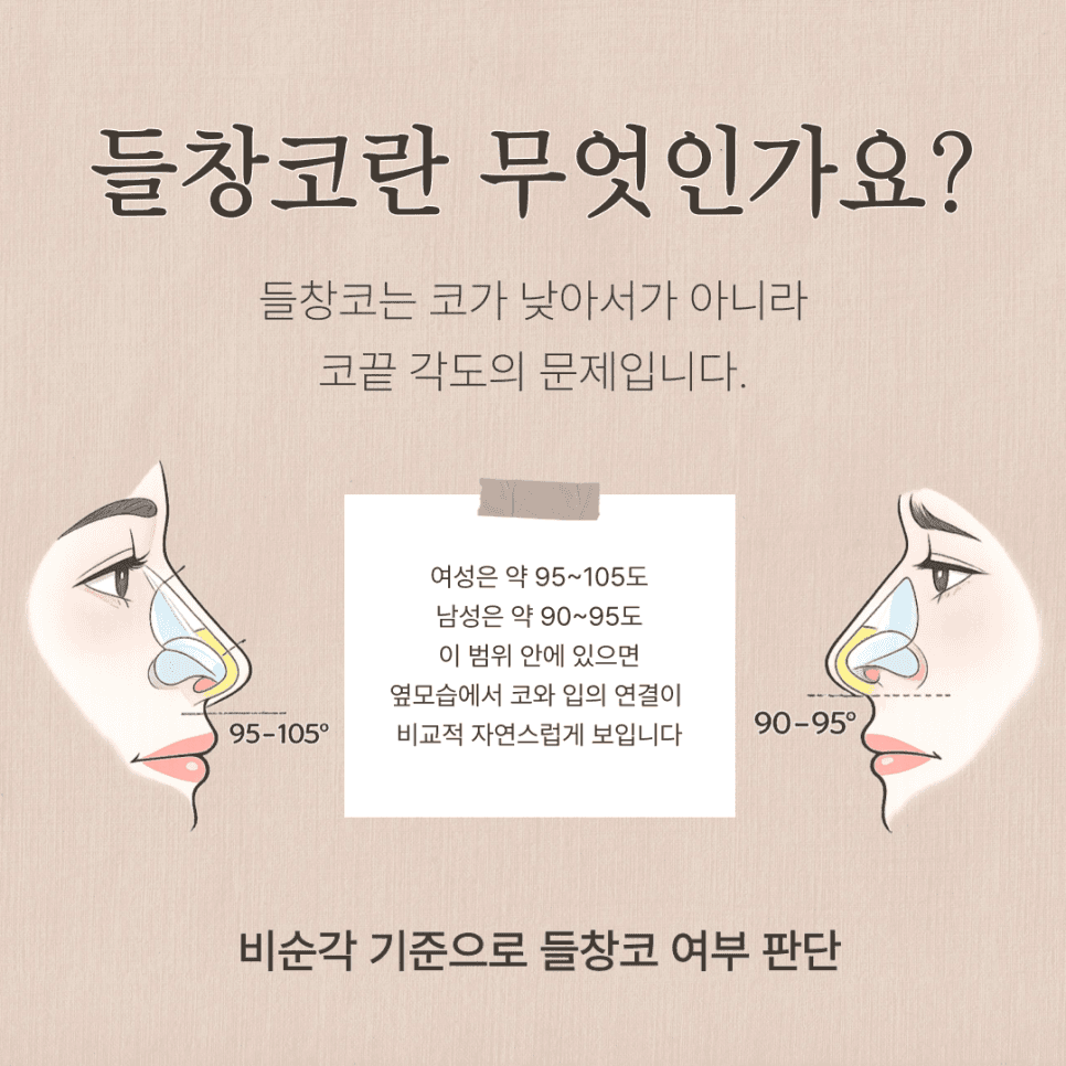들창코교정, 코끝이 들려 보이는 이유와 자가늑연골을 고려하는 기준 관련 이미지 2/9
