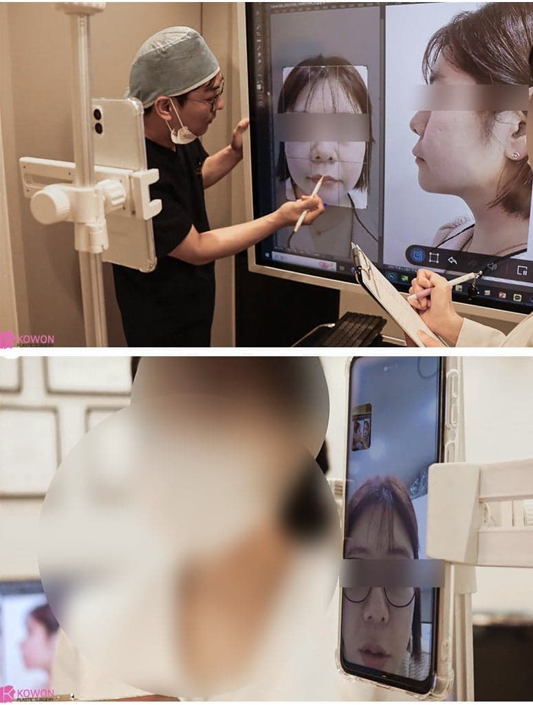 코끝재수술, 들린코가 됐다면 무엇부터 확인해야 하나요 — 비순각과 비주 지지 구조 관련 이미지 5/5