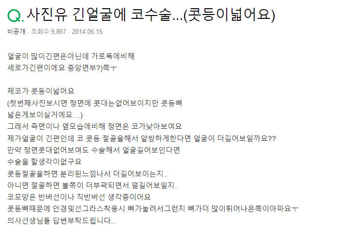넓은 콧등뼈 절골술, 긴 얼굴이 더 길어 보일까 — 폭과 길이의 관계 관련 이미지 2/4