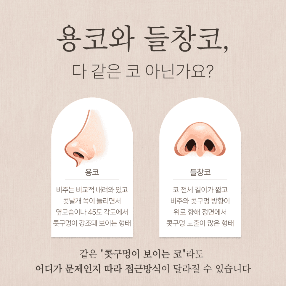비공내리기와 용코 — 들창코와 무엇이 다르고, 어떤 기준으로 판단할까 관련 이미지 2/6
