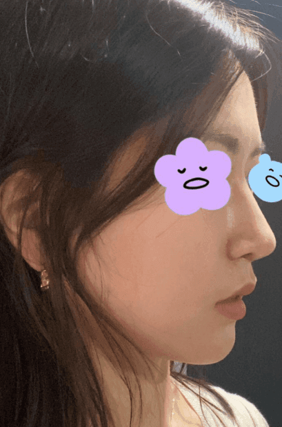 Patient review — Korean patient review #41