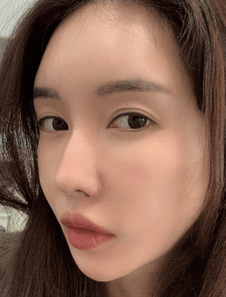 Patient review — Korean patient review #50