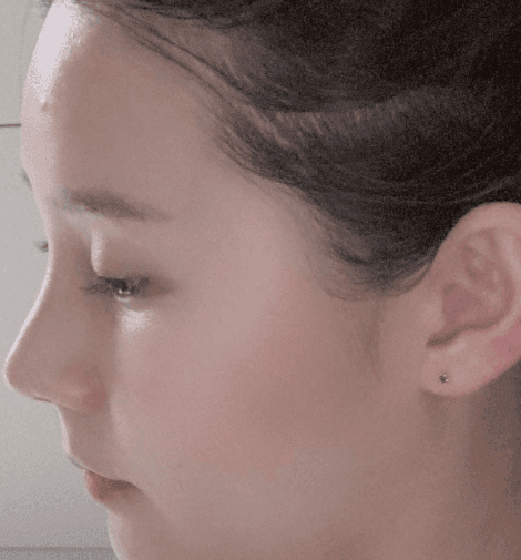 Patient review — Korean patient review #49