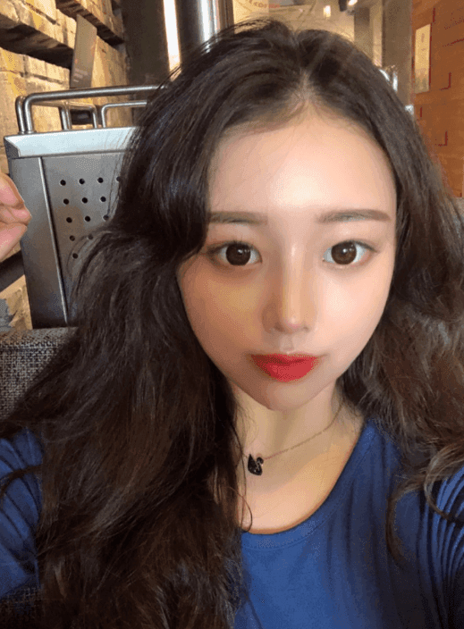 Patient review — Korean patient review #43