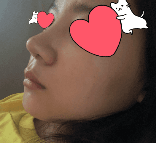 Patient review — Korean patient review #33