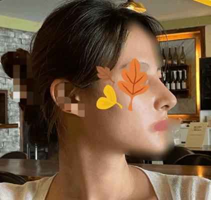 Patient review — Korean patient review #32