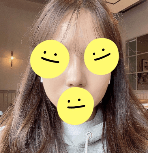 Patient review — Korean patient review #35