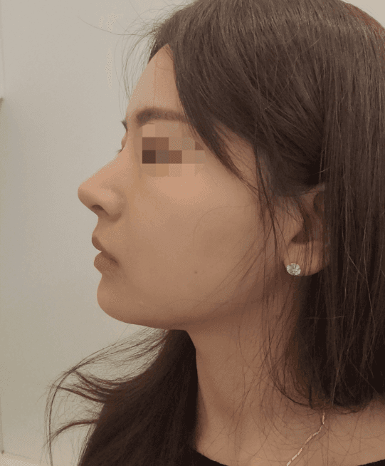 Patient review — Korean patient review #34