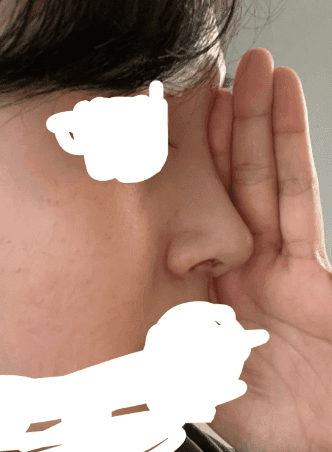 Patient review — Korean patient review #52
