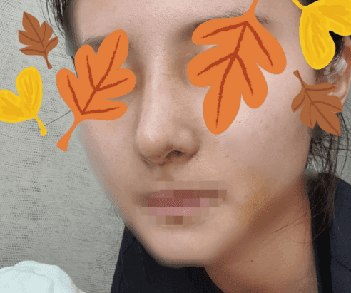 Patient review — Korean patient review #36