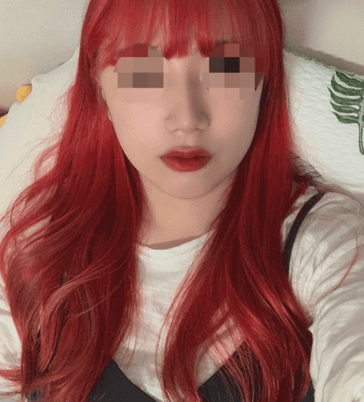 Patient review — Korean patient review #38