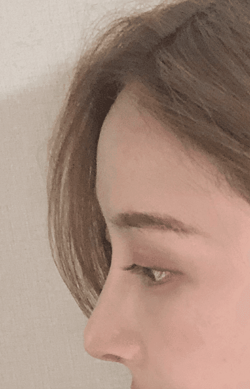 Patient review — Korean patient review #37