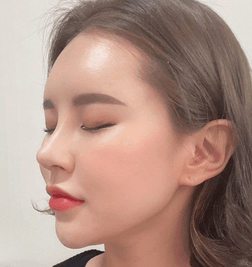 Patient review — Korean patient review #39