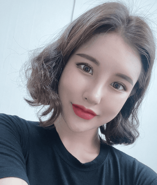 코 재수술+지방이식 너무 만족 합니다 ㅠㅠ 수술후기 사진 3