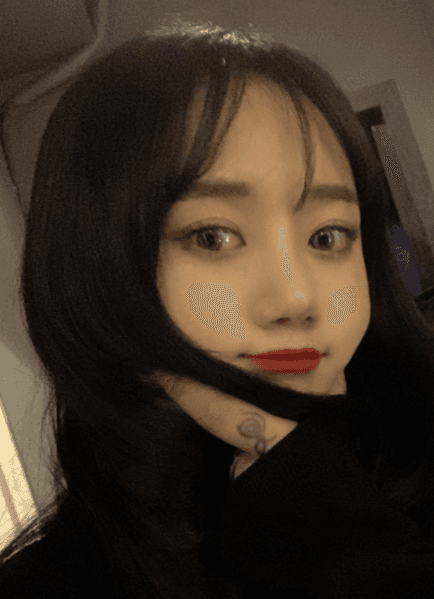 코로 인생역전 수술후기 사진 2
