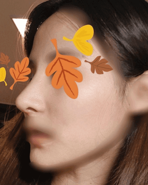 환자수술후기 — 수술 너무 만족합니다!