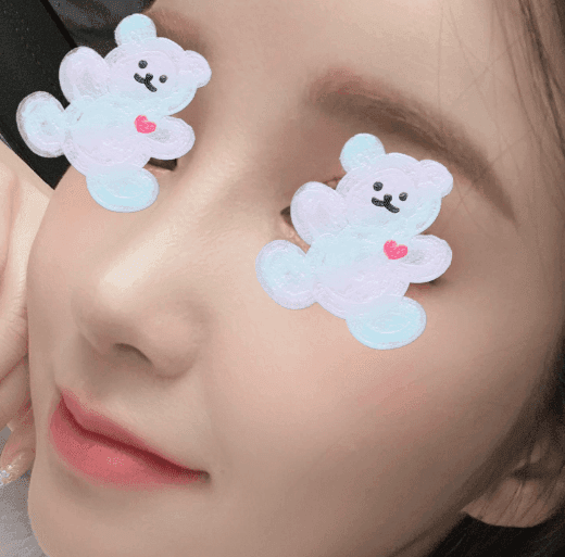 환자수술후기 — 지금 너무 마음에 드는뎅!