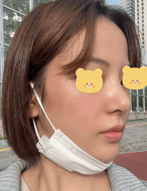 환자수술후기 — 최고인것 같습니다!!