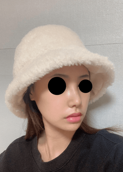 후회 없는 수술 에요 ♥ 수술후기 사진 3