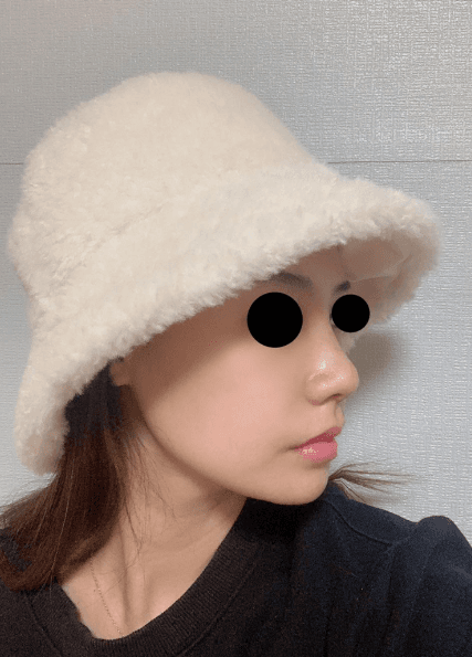 후회 없는 수술 에요 ♥ 수술후기 사진 4
