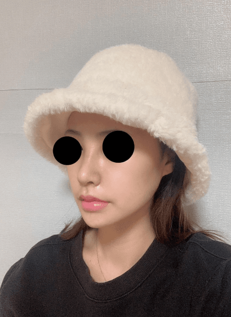 후회 없는 수술 에요 ♥ 수술후기 사진 5