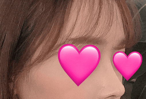 환자수술후기 — 너무 만족스러운 생활을 하는 중입니당~!!~