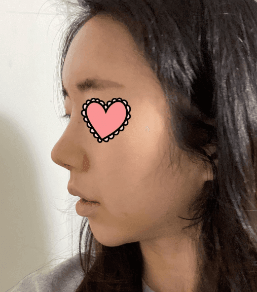 Patient review — Korean patient review #7