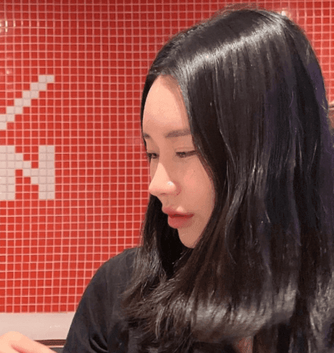 환자수술후기 — 전후차이 보면 너무 신기해요