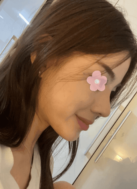 환자수술후기 — 제자신을 무척 칭찬해요ㅎㅎ