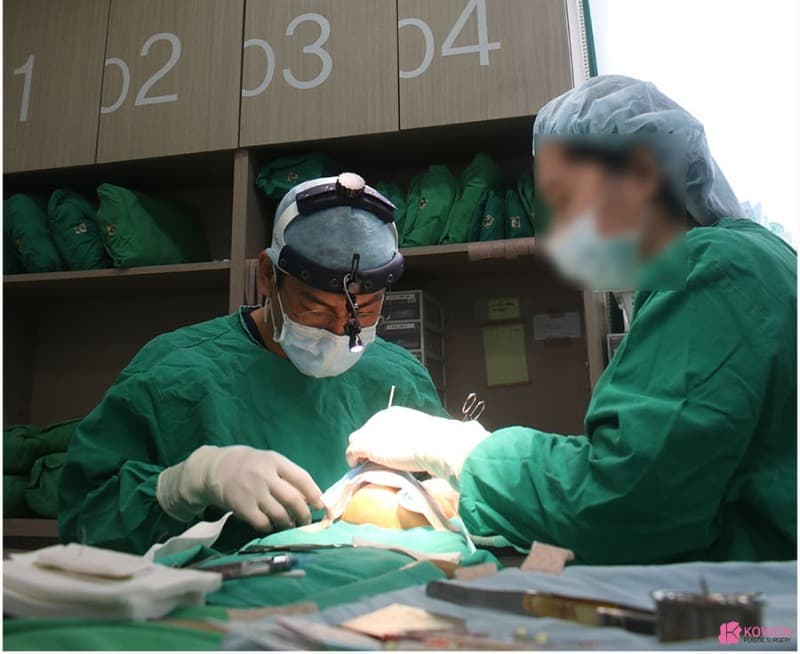 자가늑코수술로 진행한 코재수술후기, 매부리코교정 변화 과정 정리 — 코성형 정보 이미지