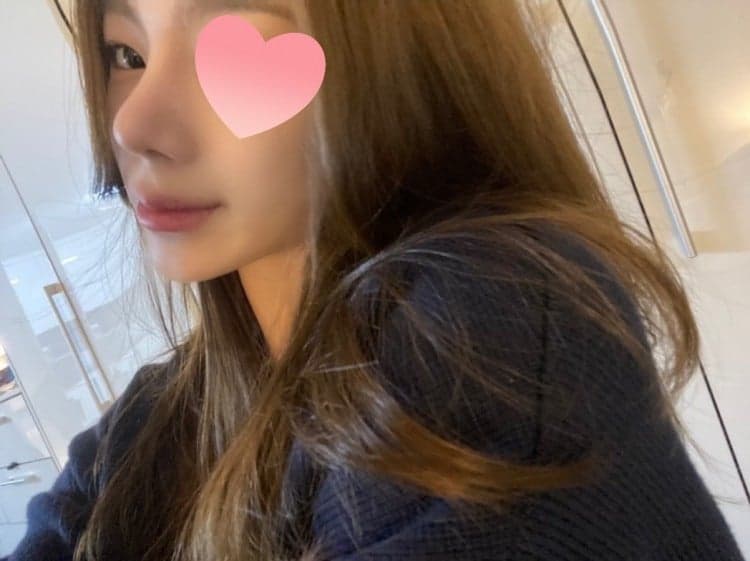 환자수술후기 — 좀 화려한 스타일로 재수술을 받았습니다.