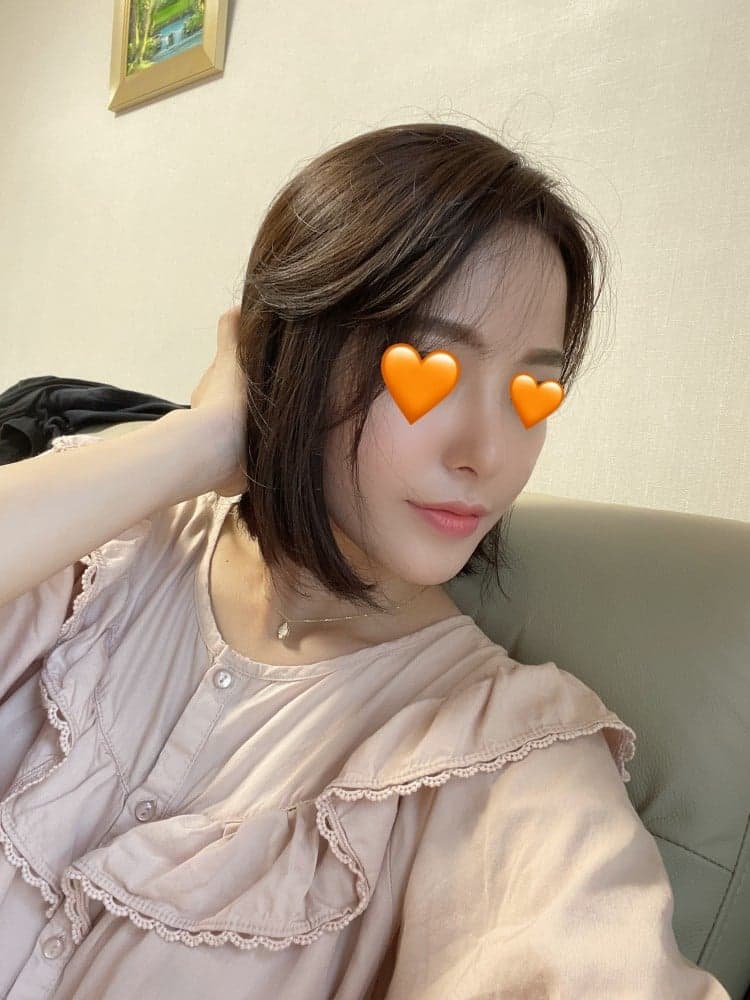 환자수술후기 — 정말 만족 합니다 너무 예뻐용