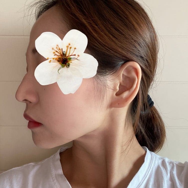 Patient review — Korean patient review #19