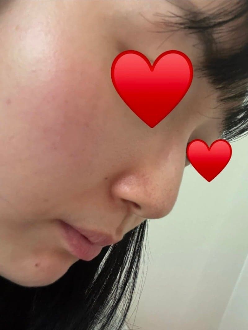 Patient review — Korean patient review #64