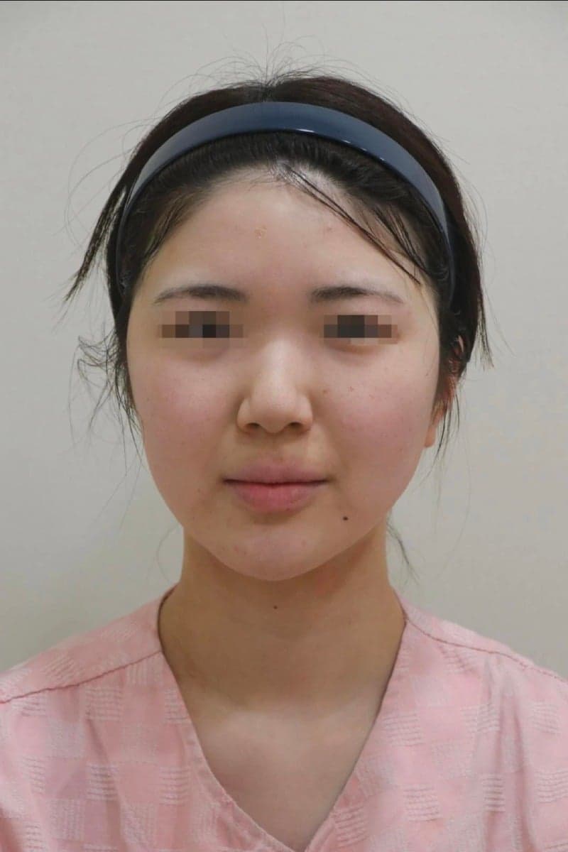 Patient review — Korean patient review #63