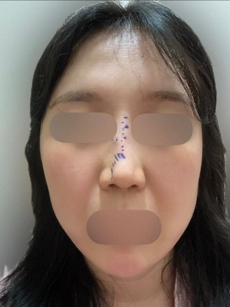 Patient review — Korean patient review #61