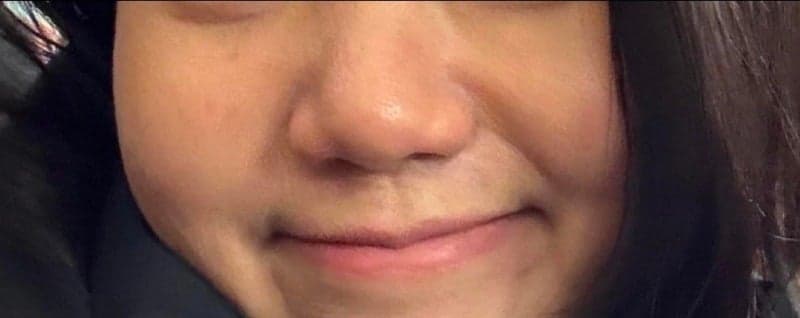 Patient review — Korean patient review #60