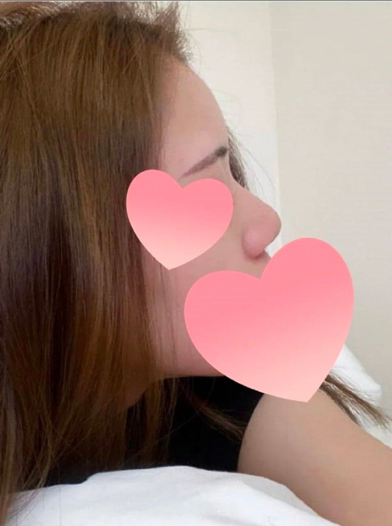 Patient review — Korean patient review #59