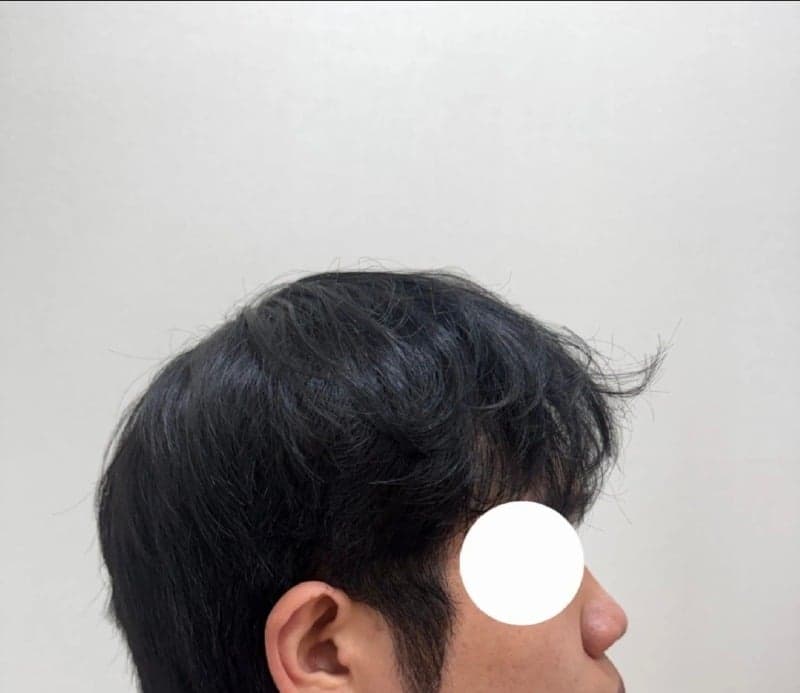 Patient review — Korean patient review #58